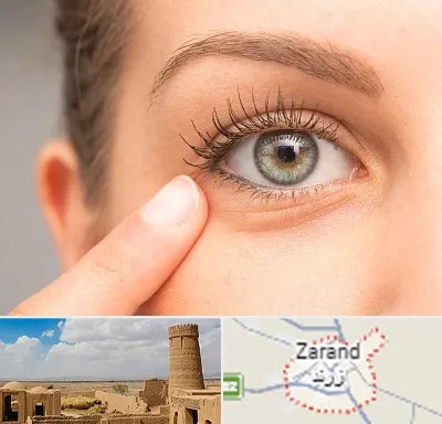 جراح پف چشم در زرند