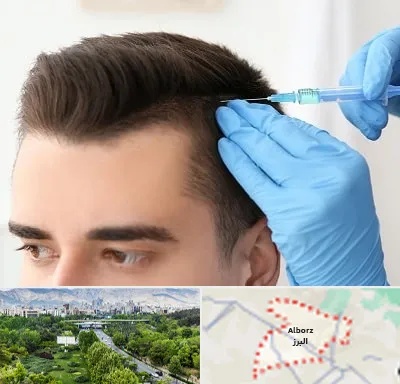 مزوتراپی مو در البرز