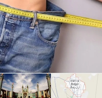 عمل لیپوماتیک در آران و بیدگل