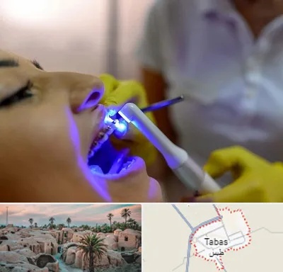 دندانپزشکی با لیزر در طبس