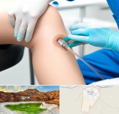 اوزون تراپی در گرمسار