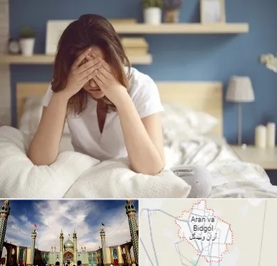درمان زگیل تناسلی زنان در آران و بیدگل