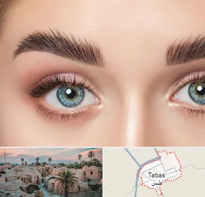 لیفت ابرو در طبس