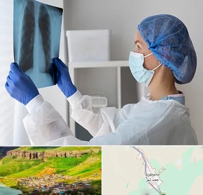 جراح سرطان مغز و استخوان در عجب شیر