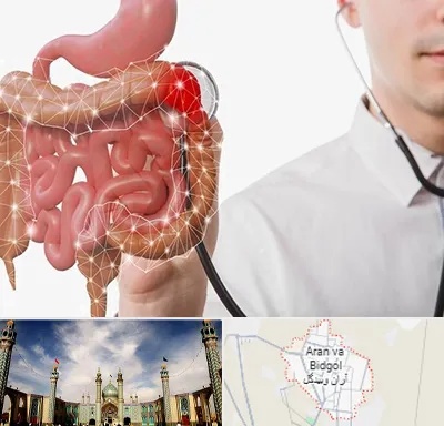 دکتر سرطان روده بزرگ در آران و بیدگل