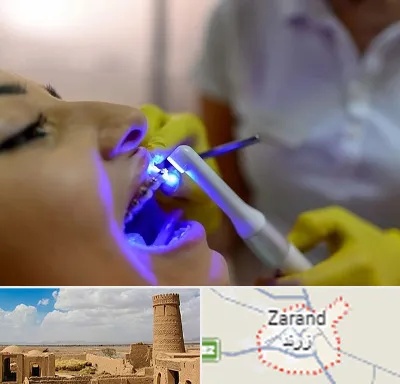 دندانپزشکی با لیزر در زرند
