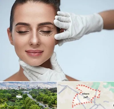 عمل پف چشم در البرز