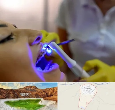 دندانپزشکی با لیزر در گرمسار