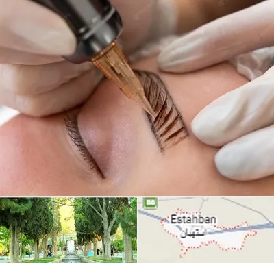 میکروبلیدینگ در استهبان