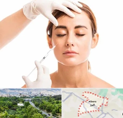 تزریق ژل گونه در البرز