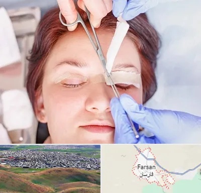 جراحی پلک افتاده در فارسان