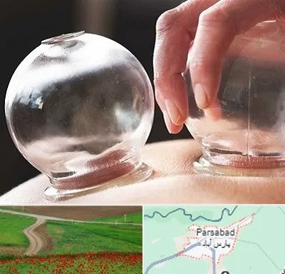 مرکز حجامت در پارس آباد