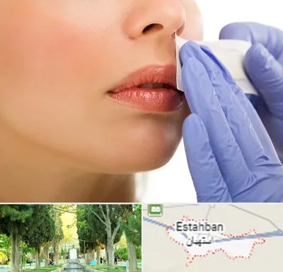 اپیلاسیون صورت در استهبان