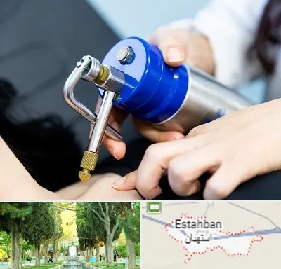 کرایوتراپی در استهبان