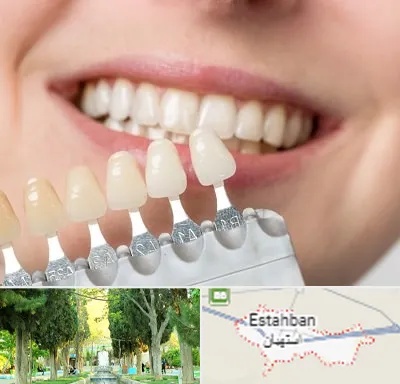 مرکز کامپوزیت دندان در استهبان