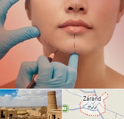 دکتر زیبایی خانم در زرند