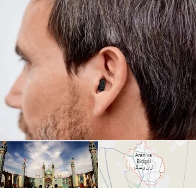 سمعک نامرئی در آران و بیدگل