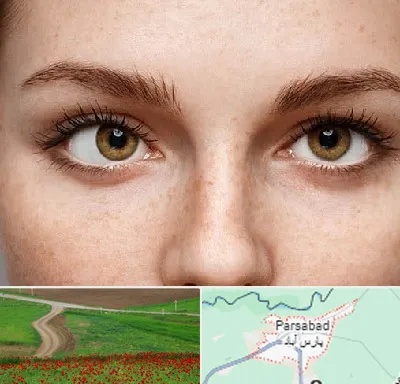متخصص انحراف چشم در پارس آباد