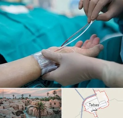 آنژیوگرافی در طبس