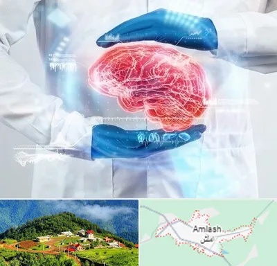 دکتر مغز و اعصاب در املش