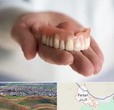 لیفت لثه با لیزر در فارسان