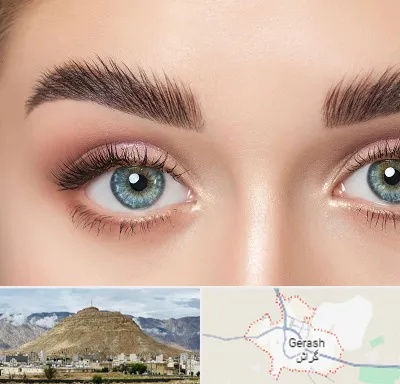 لیفت ابرو در گراش