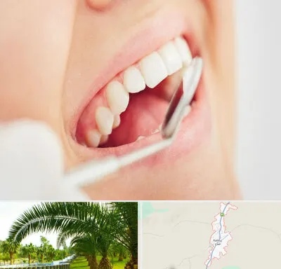 اصلاح طرح لبخند در کهنوج