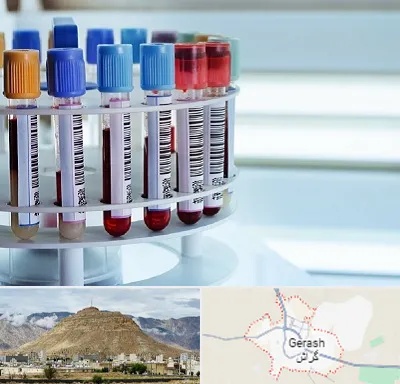 آزمایشگاه ژنتیک در گراش