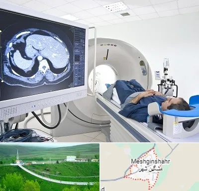 مرکز تصویر برداری پزشکی در مشگین شهر