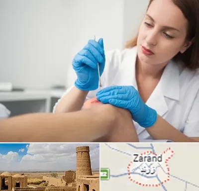 متخصص زخم در زرند