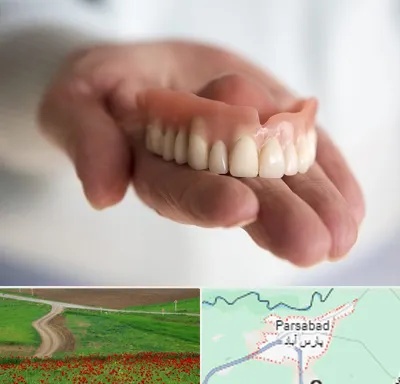 لیفت لثه با لیزر در پارس آباد