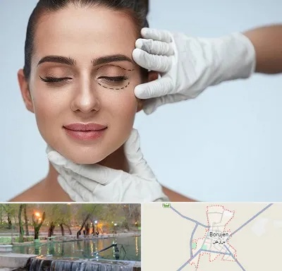 عمل پف چشم در بروجن