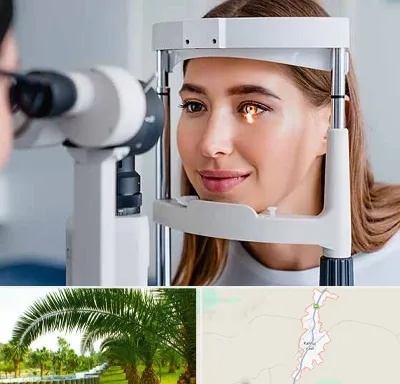 دکتر چشم پزشک خوب در کهنوج