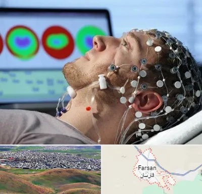 مرکز نوار مغز در فارسان
