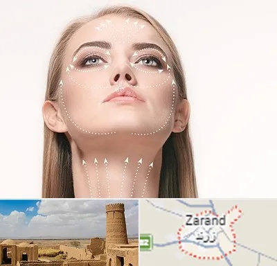 لیفت صورت با نخ در زرند