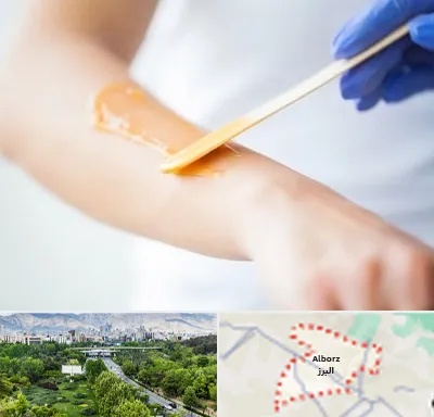 اپیلاسیون کار در البرز