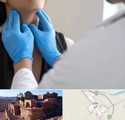 دکتر سرطان گلو در قائن