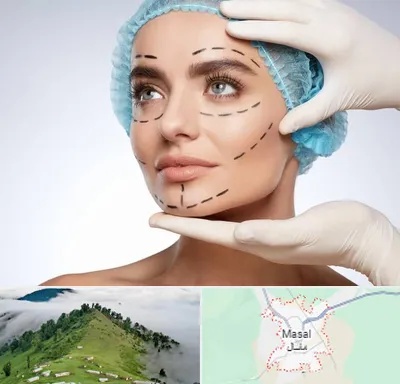 جراحی زیبایی در ماسال