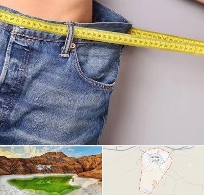 عمل لیپوماتیک در گرمسار