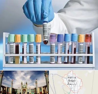 آزمایشگاه شبانه روزی در آران و بیدگل