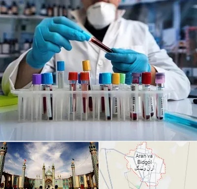آزمایشگاه خون در آران و بیدگل