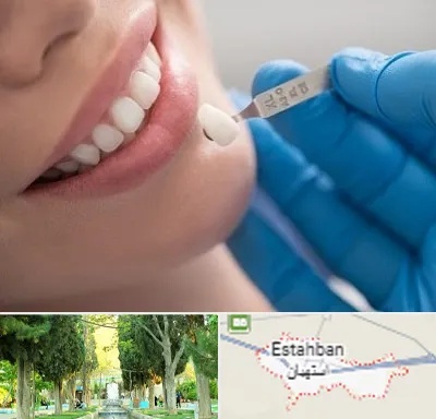مرکز لمینت دندان در استهبان