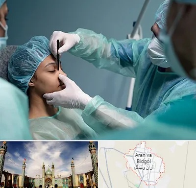 عمل بینی ارزان در آران و بیدگل