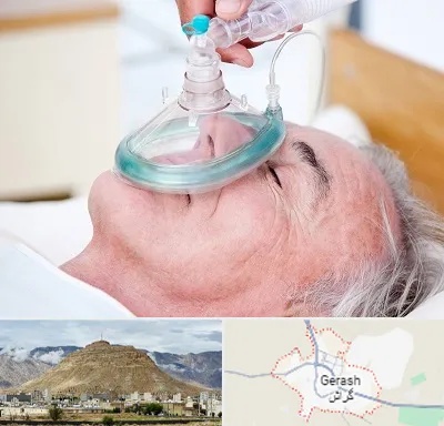 کرایه کپسول اکسیژن در گراش