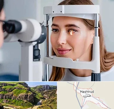 دکتر چشم پزشک خوب در هشترود