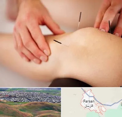 دکتر طب سوزنی برای لاغری در فارسان