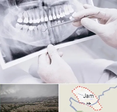 رادیولوژی دهان و دندان در جم