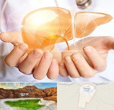 دکتر سرطان کبد در گرمسار