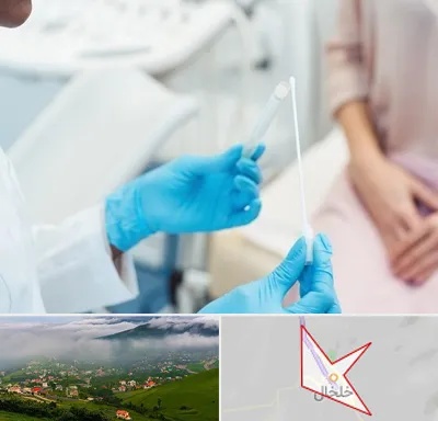 دکتر زگیل تناسلی HPV در خلخال