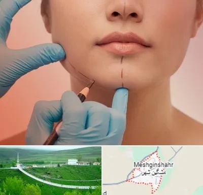 دکتر زیبایی خانم در مشگین شهر